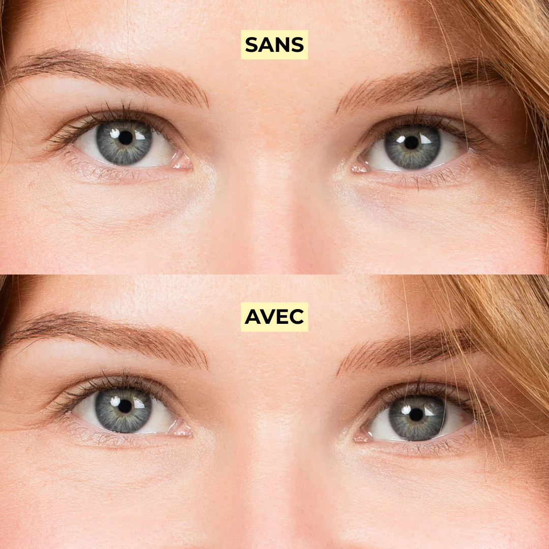 Miniature 22